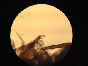 Springtail claw under high power magnification.